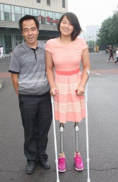 残疾人奥运会游泳比赛_残奥会游泳选手哪里残疾_残疾奥运会游泳冠军